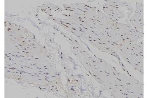 ABIN6263438 and ABIN6266721 at 1/100 staining Human gastric tissue by IHC-P. (Musculin Antikörper  (Internal Region))