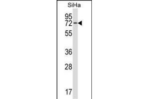 HSPA12B Antikörper  (N-Term)