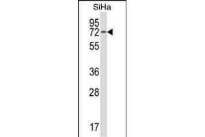 HSB Antibody (N-term) (ABIN657502 and ABIN2846527) western blot analysis in SiHa cell line lysates (35 μg/lane). (HSPA12B Antikörper  (N-Term))