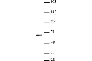 KLF5 antibody (pAb) tested by Western Blot. (KLF5 Antikörper  (N-Term))