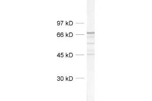 dilution: 1 : 1000, sample: rat brain homogenate (NEFL Antikörper  (AA 1-284))