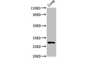 Western Blot Positive WB detected in: Rat lung tissue All lanes: SYNPR antibody at 3 μg/mL Secondary Goat polyclonal to rabbit IgG at 1/50000 dilution Predicted band size: 30, 32 kDa Observed band size: 30 kDa (Synaptoporin Antikörper  (AA 199-265))
