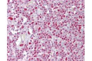 Anti-H2AX antibody IHC of human tonsil. (H2AFX Antikörper  (C-Term))