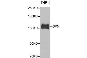Western blot analysis of extracts of THP-1 cell line, using SPN antibody. (CD43 Antikörper)