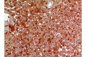 Immunohistochemistry (IHC) analysis of paraffin-embedded Human Liver, antibody was diluted at 1:100. (alpha 2 Macroglobulin Antikörper  (Internal Region))