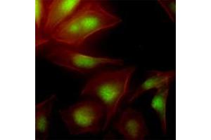 Immunofluorescence (IF) image for anti-Ubiquitin-Conjugating Enzyme E2S (UBE2S) (AA 1-222), (N-Term) antibody (ABIN452460) (UBE2S Antikörper  (N-Term))