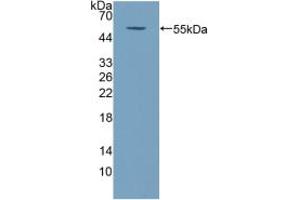 Western blot analysis of recombinant Human COQ6. (COQ6 Antikörper  (AA 1-468))