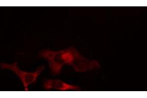 ABIN6266897 staining HeLa cells by IF/ICC. (ELOVL4 Antikörper  (Internal Region))