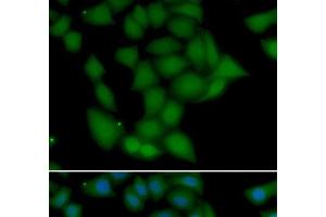 Immunofluorescence analysis of U2OS cells using CAMK1 Polyclonal Antibody (CAMK1 Antikörper)