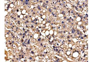 IHC analysis of PPFIA1 using anti-PPFIA1 antibody (ABIN7600454).