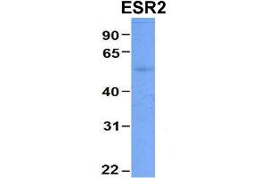Host:  Rabbit  Target Name:  CHAD  Sample Type:  Human Adult Placenta  Antibody Dilution:  1. (ESR2 Antikörper  (Middle Region))