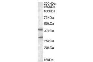 Image no. 1 for anti-Src Kinase Associated Phosphoprotein 2 (SKAP2) (C-Term) antibody (ABIN374180) (SKAP2 Antikörper  (C-Term))