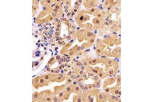 (ABIN6243211 and ABIN6577174) staining GDH in human kidney tissue sections by Immunohistochemistry (IHC-P - paraformaldehyde-fixed, paraffin-embedded sections). (GAPDH Antikörper  (AA 43-335))