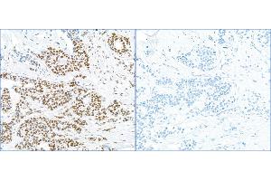 Immunohistochemistry (IHC) image for anti-Replication Protein A2, 32kDa (RPA2) (pSer4), (pSer8) antibody (ABIN7455212) (RPA2 Antikörper  (pSer4, pSer8))