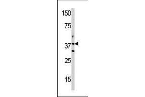 Western blot analysis of DIMT1L polyclonal antibody  in T-47D cell line lysate (35 ug/lane). (DIMT1 Antikörper  (C-Term))