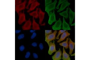 ABIN6257478 and ABIN6273810 staining Hela cells(45 min of heat-shock treatment) by IF/ICC. (TYRO3 Antikörper  (C-Term))