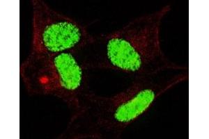 Fluorescent confocal image of SY5Y cells stained with phospho-LIN28 antibody. (LIN28A Antikörper  (pSer134))
