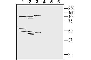 1-3. (Adiponectin Receptor 1 Antikörper  (Intracellular, N-Term))