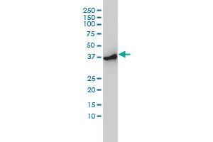 ACTR2 monoclonal antibody (M01), clone 1B10-C4 Western Blot analysis of ACTR2 expression in Hela S3 NE . (ACTR2 Antikörper  (AA 1-394))