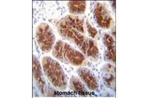 Immunohistochemistry (Paraffin-embedded Sections) (IHC (p)) image for anti-Claudin 2 (CLDN2) (AA 200-227), (C-Term) antibody (ABIN656564)