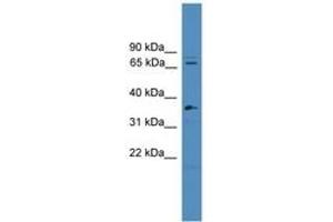 Splicing Factor 4 Antikörper  (C-Term)