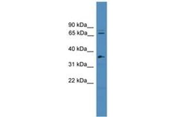 Splicing Factor 4 Antikörper  (C-Term)