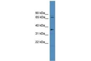 Image no. 1 for anti-Splicing Factor 4 (SF4) (C-Term) antibody (ABIN6745313) (Splicing Factor 4 Antikörper  (C-Term))