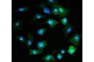 anti-Proteasome (Prosome, Macropain) 26S Subunit, Non-ATPase, 8 (PSMD8) (AA 86-350) antibody