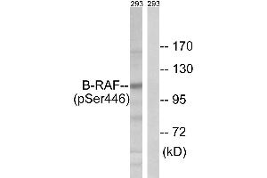 Immunohistochemistry analysis of paraffin-embedded human brain tissue using B-RAF (Phospho-Ser446) antibody. (SNRPE Antikörper  (pSer446))