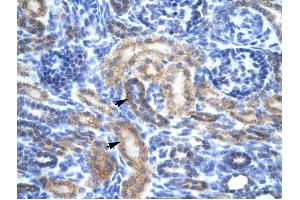 OR13C9 antibody was used for immunohistochemistry at a concentration of 4-8 ug/ml to stain Epithelial cells of renal tubule (arrows) in Human Kidney.