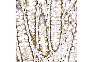 Immunohistochemistry of paraffin-embedded human colon using Prdm9 Rabbit mAb (ABIN7269500) at dilution of 1:800 (40x lens). (PRDM9 Antikörper)