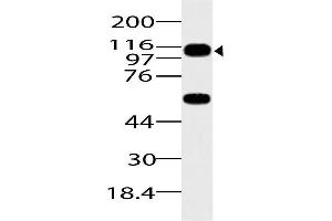 Image no. 1 for anti-ArfGAP with SH3 Domain, Ankyrin Repeat and PH Domain 1 (ASAP1) (AA 912-1115) antibody (ABIN5027041) (ASAP1 Antikörper  (AA 912-1115))