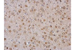 IHC-P Image Galanin Receptor 2 antibody detects Galanin Receptor 2 protein at membrane and cytosol on rat fore brain by immunohistochemical analysis. (GALR2 Antikörper  (C-Term))