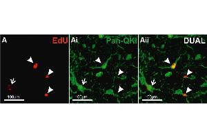 Representative confocal images of colocalisation of EdU+ and Pan-QKI in the dorsal WM of mouse spinal cord.