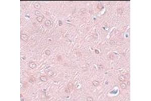 Immunohistochemistry of SYNGR2 in rat brain tissue with this product at 2. (SYNGR2 Antikörper  (N-Term))