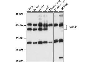Western blot analysis of extracts of various cell lines, using SUGT1 antibody (ABIN7270270) at 1:1000 dilution. (SUGT1 Antikörper  (AA 159-333))