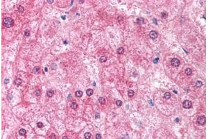 Human Liver (formalin-fixed, paraffin-embedded) stained with EIF2AK2 antibody ABIN213926 at 5 ug/ml followed by biotinylated goat anti-rabbit IgG secondary antibody ABIN481713, alkaline phosphatase-streptavidin and chromogen. (EIF2AK2 Antikörper  (N-Term))