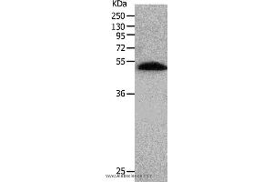 Western blot analysis of Human lung tissue, using BPIFB2 Polyclonal Antibody at dilution of 1:530