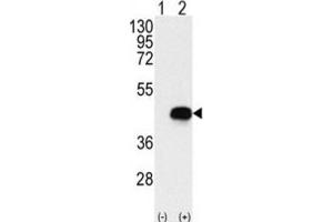 Western Blotting (WB) image for anti-Branched Chain Ketoacid Dehydrogenase Kinase (BCKDK) antibody (ABIN3003001) (BCKDK Antikörper)
