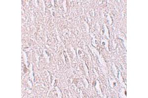 Immunohistochemical staining of human brain cells with ZBTB5 polyclonal antibody  at 2. (ZBTB5 Antikörper  (C-Term))