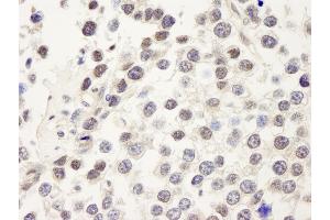 Immunohistochemistry (IHC) image for anti-Cell Division Cycle 25 Homolog C (S. Pombe) (CDC25C) (AA 150-200) antibody (ABIN7448466) (CDC25C Antikörper  (AA 150-200))