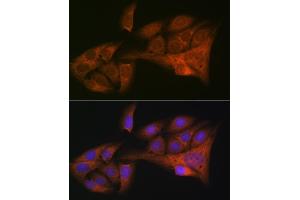 Immunofluorescence analysis of U-2 OS cells using HE4/WFDC2 Rabbit mAb (ABIN1682653, ABIN3017632, ABIN3017633 and ABIN7101513) at dilution of 1:100 (40x lens). (WFDC2 Antikörper)