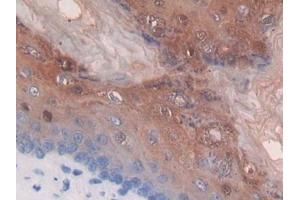 DAB staining on IHC-P; Samples: Mouse Stomach Tissue (Thymidine Phosphorylase Antikörper  (AA 29-305))