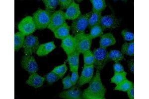 IF analysis of HSPB8/Hsp22 using anti-HSPB8/Hsp22 antibody (ABIN7599067).
