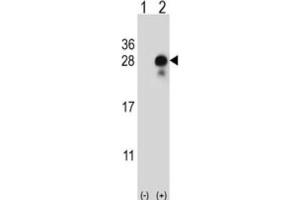 Western Blotting (WB) image for anti-delta-Like 2 Homolog (DLK2) antibody (ABIN5024466) (DLK2 Antikörper)