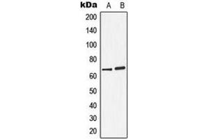 Western blot analysis of Arylsulfatase D expression in A549 (A), ZR751 (B) whole cell lysates. (Arylsulfatase D Antikörper  (Center))