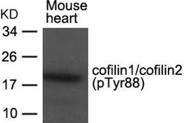 Cofilin1/2 (CFL1/2) (pTyr88) anticorps