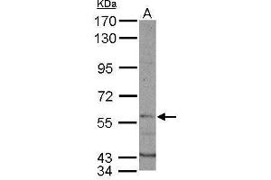 WB Image Sample (50 ug of whole cell lysate) A: mouse liver 7. (DYRK1B Antikörper  (N-Term))