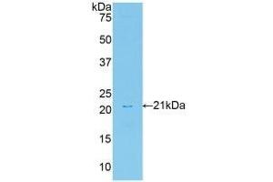 Detection of Recombinant HGF, Rat using Polyclonal Antibody to Hepatocyte Growth Factor (HGF) (HGF Antikörper  (AA 306-471))