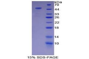 SDS-PAGE analysis of Pig Complement Component 7 Protein. (C7 Protein)